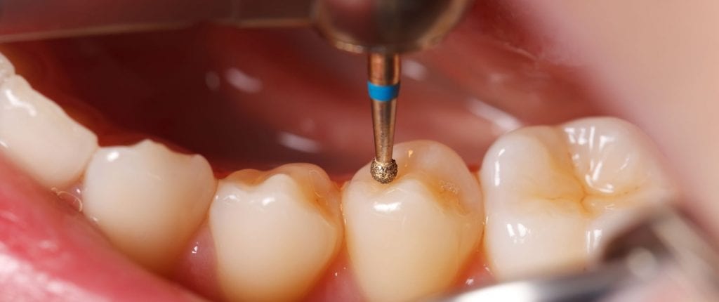 restorative dentistry